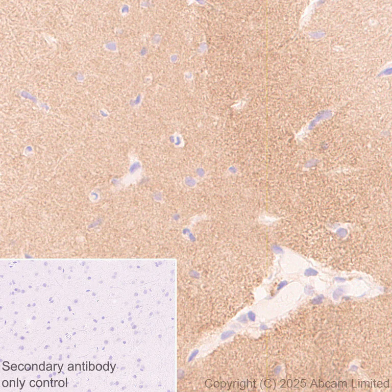 Immunohistochemistry (Formalin/PFA-fixed paraffin-embedded sections) - Anti-Neogenin antibody [EPR30444-522] - BSA and Azide free (AB326594)