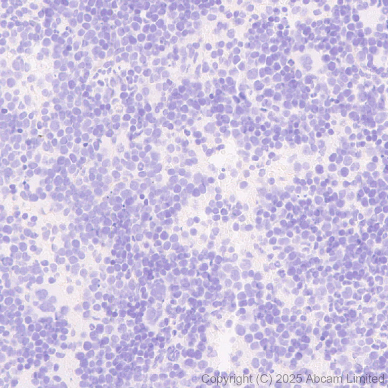 Immunohistochemistry (Formalin/PFA-fixed paraffin-embedded sections) - Anti-Neogenin antibody [EPR30444-522] - BSA and Azide free (AB326594)