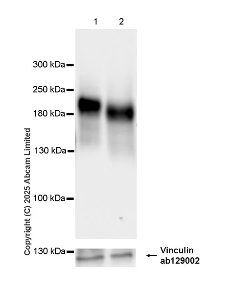Western blot - Anti-Neogenin antibody [EPR30444-522] - BSA and Azide free (AB326594)
