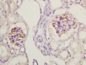 Immunohistochemistry (Formalin/PFA-fixed paraffin-embedded sections) - Anti-Nephrin antibody (AB216692), expandable thumbnail