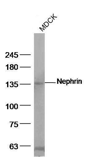 Western blot - Anti-Nephrin antibody (AB216692), expandable thumbnail
