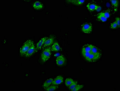 Immunocytochemistry/ Immunofluorescence - Anti-Nephrin antibody (AB235903)