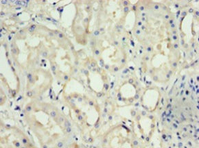 Immunohistochemistry (Formalin/PFA-fixed paraffin-embedded sections) - Anti-Nephrin antibody (AB235903)