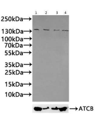 Western blot - Anti-Nephrin antibody (AB235903)