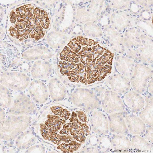 Anti-Nephrin antibody (ab85379) | Abcam