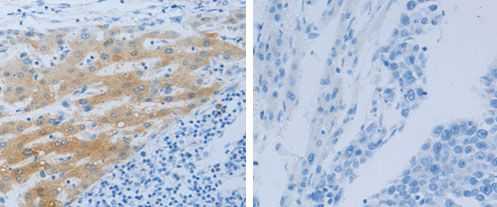Immunohistochemistry (Formalin/PFA-fixed paraffin-embedded sections) - Anti-Nephrin antibody - C-terminal (AB183099)