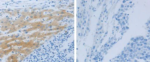 Immunohistochemistry (Formalin/PFA-fixed paraffin-embedded sections) - Anti-Nephrin antibody - C-terminal (AB183099)