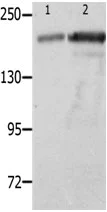 Western blot - Anti-Nephrin antibody - C-terminal (AB183099)