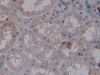 Immunohistochemistry (Formalin/PFA-fixed paraffin-embedded sections) - Anti-Nephrin antibody [C8] (AB239476), expandable thumbnail
