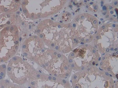 Immunohistochemistry (Formalin/PFA-fixed paraffin-embedded sections) - Anti-Nephrin antibody [C8] (AB239476)