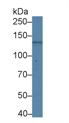 Western blot - Anti-Nephrin antibody [C8] (AB239476), expandable thumbnail