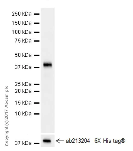 Western blot - Anti-Nephrin antibody [EPR20993] (AB216341)