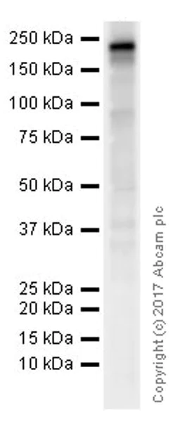 Western blot - Anti-Nephrin antibody [EPR20993] (AB216341)