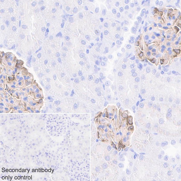 Immunohistochemistry (Formalin/PFA-fixed paraffin-embedded sections) - Anti-Nephrin antibody [EPR20993] - BSA and Azide free (AB227806)