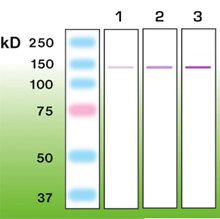 Western blot - Anti-Nephrin antibody [Y17-R] (AB136894)