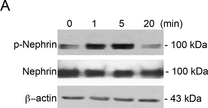 Western blot - Anti-Nephrin (phospho Y1176 + Y1193) antibody [EPTPG1] (AB80299)