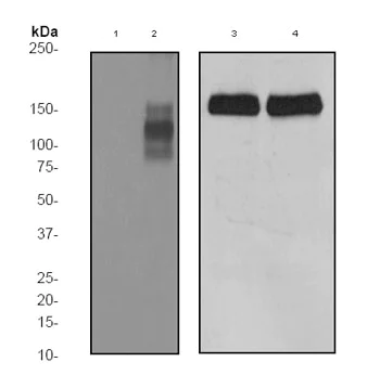 Western blot - Anti-Nephrin (phospho Y1176 + Y1193) antibody [EPTPG1] (AB80299)