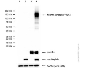 Western blot - Anti-Nephrin (phospho Y1217) antibody [EPTPG3] - BSA and Azide free (AB239894)