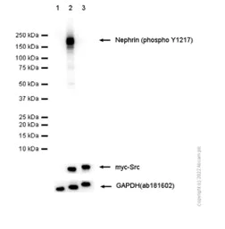 Western blot - Anti-Nephrin (phospho Y1217) antibody [EPTPG3] - BSA and Azide free (AB239894)