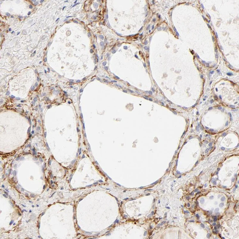 Immunohistochemistry (Formalin/PFA-fixed paraffin-embedded sections) - Anti-nephronectin antibody (AB272549)