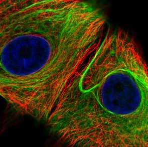 Immunocytochemistry - Anti-Nesprin 2 antibody (AB204308)