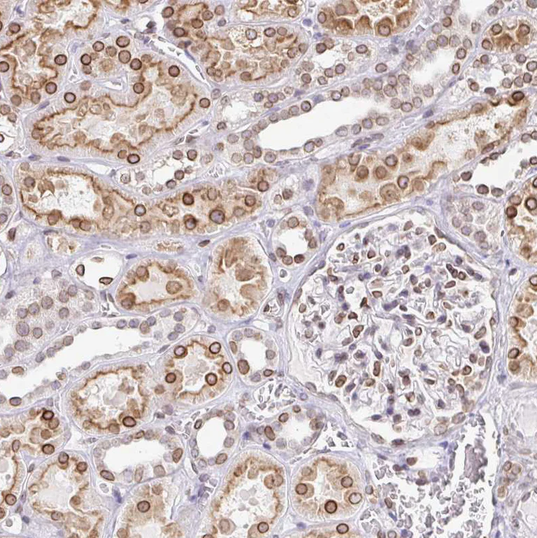 Immunohistochemistry (Formalin/PFA-fixed paraffin-embedded sections) - Anti-Nesprin 2 antibody (AB204308)