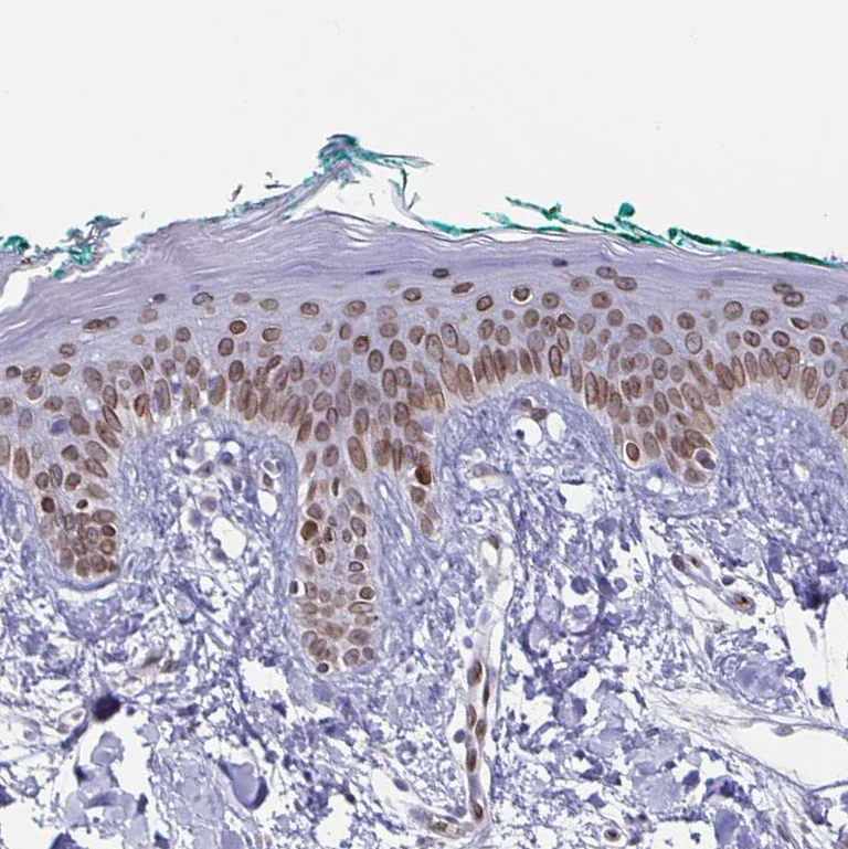 Immunohistochemistry (Formalin/PFA-fixed paraffin-embedded sections) - Anti-Nesprin 2 antibody (AB204308)