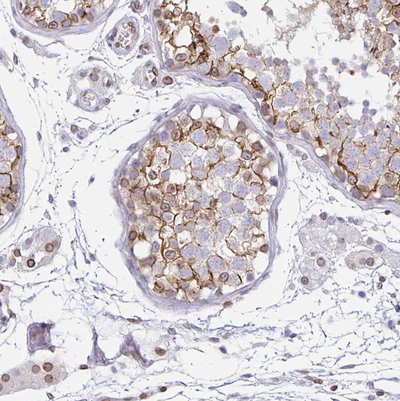 Immunohistochemistry (Formalin/PFA-fixed paraffin-embedded sections) - Anti-Nesprin 2 antibody (AB204308)