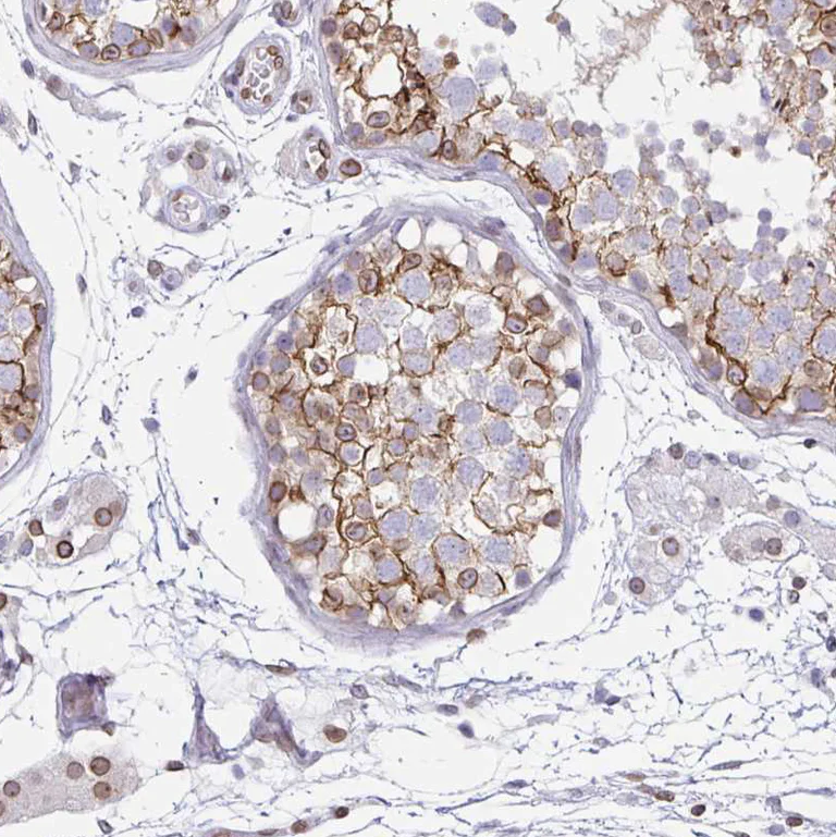 Immunohistochemistry (Formalin/PFA-fixed paraffin-embedded sections) - Anti-Nesprin 2 antibody (AB204308)