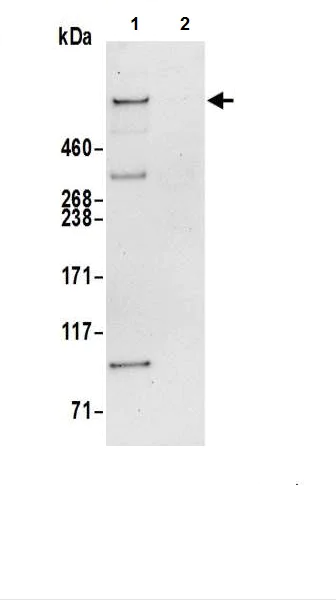 Immunoprecipitation - Anti-Nesprin 2 antibody (AB217057)