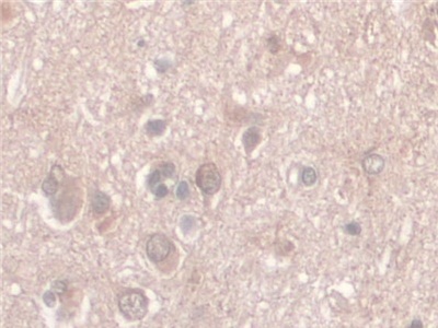 Immunohistochemistry (Formalin/PFA-fixed paraffin-embedded sections) - Anti-Nesprin 2 antibody (AB233034)