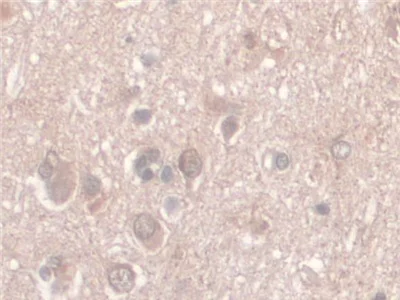 Immunohistochemistry (Formalin/PFA-fixed paraffin-embedded sections) - Anti-Nesprin 2 antibody (AB233034)