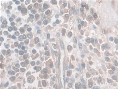 Immunohistochemistry (Formalin/PFA-fixed paraffin-embedded sections) - Anti-Nesprin 2 antibody (AB233034)
