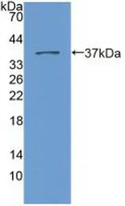 Western blot - Anti-Nesprin 2 antibody (AB233034)