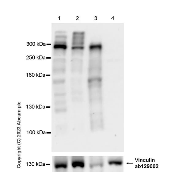 Western blot - Anti-Nesprin 2 antibody [EPR28137-54] - BSA and Azide free (AB314873)