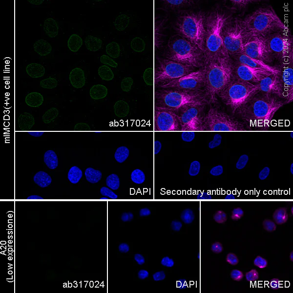 Immunocytochemistry/ Immunofluorescence - Anti-Nesprin 2 antibody [EPR28138-90] - BSA and Azide free (AB317025)