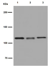 Western blot - Anti-Nesprin1/Syne-1 antibody [EPR14196] (AB192234)