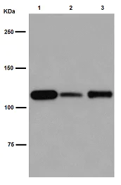 Western blot - Anti-Nesprin1/Syne-1 antibody [EPR14196] (AB192234)