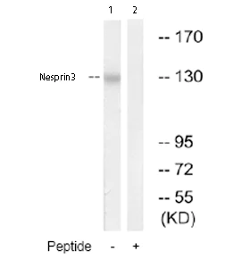 Western blot - Anti-Nesprin3 antibody (AB74261)