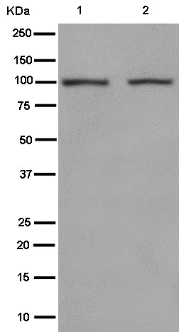 Western blot - Anti-Nesprin3 antibody [EPR15623] - BSA and Azide free (AB250898)