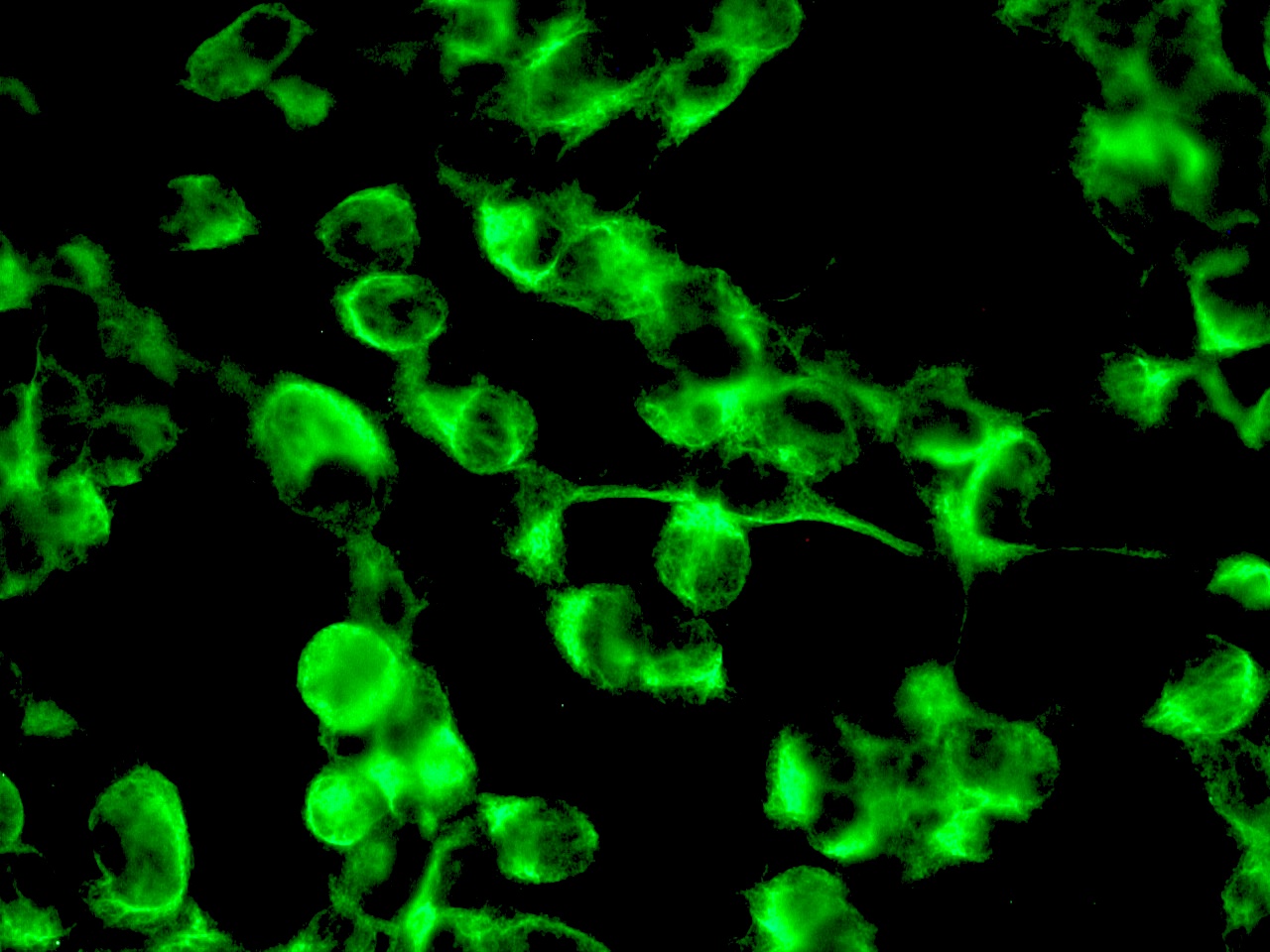 Immunocytochemistry - Anti-Nestin antibody [10C2] - Neural Stem Cell Marker (AB22035), expandable thumbnail