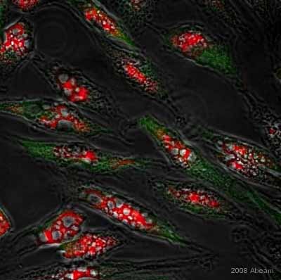 Immunocytochemistry - Anti-Nestin antibody [10C2] - Neural Stem Cell Marker (AB22035), expandable thumbnail