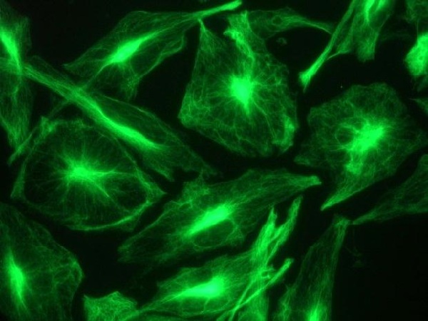 Immunocytochemistry - Anti-Nestin antibody [10C2] - Neural Stem Cell Marker (AB22035), expandable thumbnail