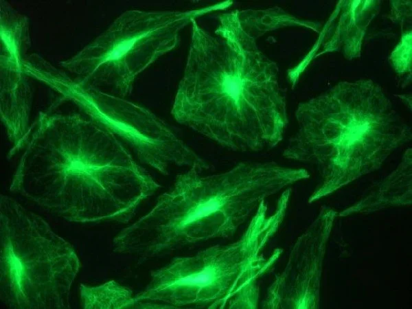 Immunocytochemistry - Anti-Nestin antibody [10C2] - Neural Stem Cell Marker (AB22035)