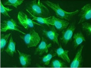 Immunocytochemistry/ Immunofluorescence - Anti-Nestin antibody [2C1.3A11] (AB18102), expandable thumbnail