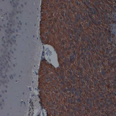 Immunohistochemistry (Formalin/PFA-fixed paraffin-embedded sections) - Anti-Nestin antibody [2C1.3A11] (ab18102), expandable thumbnail