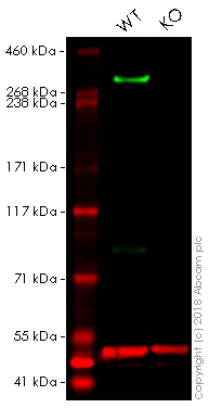 Western blot - Anti-Nestin antibody [2C1.3A11] (AB18102), expandable thumbnail
