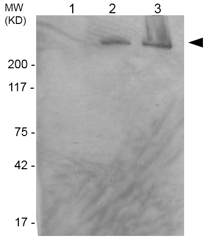 Western blot - Anti-Nestin antibody [2C1.3A11] (AB18102), expandable thumbnail