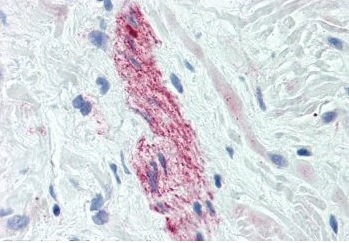 Immunohistochemistry (Formalin/PFA-fixed paraffin-embedded sections) - Anti-Nestin antibody [2C1.3A11] - Neural Stem Cell Marker (ab18102), expandable thumbnail