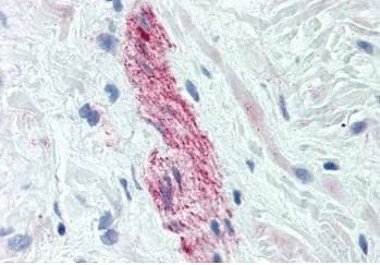 Immunohistochemistry (Formalin/PFA-fixed paraffin-embedded sections) - Anti-Nestin antibody [2C1.3A11] - Neural Stem Cell Marker (AB18102)